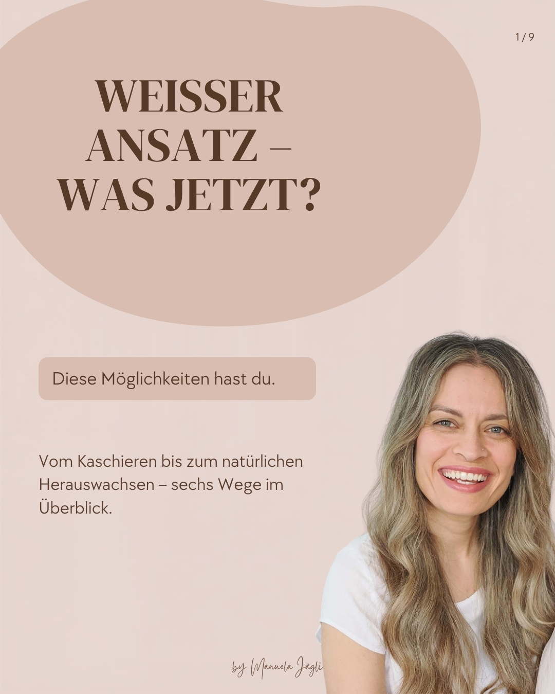 Kaschieren, integrieren oder ganz natürlich wachsen lassen? 🤍 Was fühlt sich für dich richtig an?